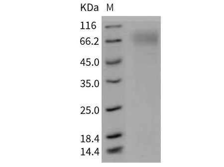 Recombinant Mouse SR-BI/CD36L1 Protein (His Tag)