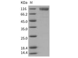 Recombinant Mouse SR-BI/CD36L1 Protein (His & Fc Tag)