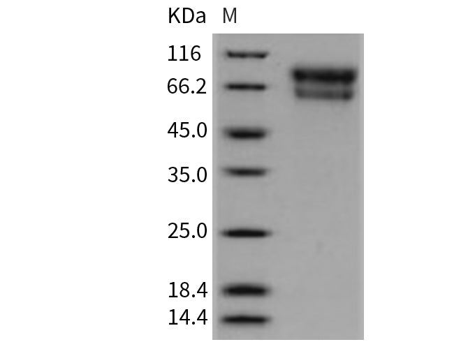 Recombinant Mouse SerpinA10/ZPI Protein (His Tag)