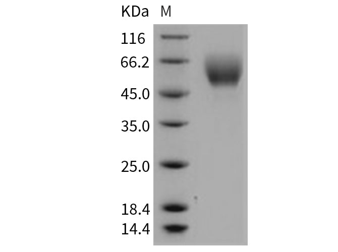 Recombinant Mouse SerpinA6/CBG Protein (His Tag)