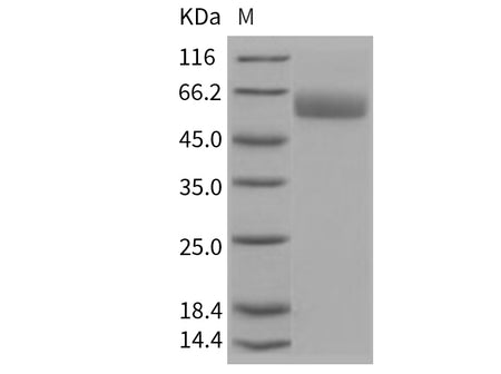 Recombinant Mouse SerpinA7/TBG Protein (His Tag)