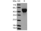 Recombinant Mouse IL2Ra/CD25 Protein (His Tag)