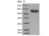 Recombinant Mouse IL6RA/CD126 Protein (His Tag)