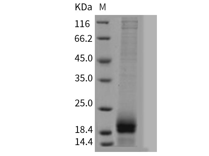 Recombinant Mouse AgRP/AGRP Protein (His Tag)