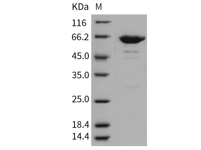 Recombinant Mouse LTA4H Protein (His Tag)(Active)