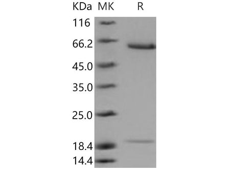 Recombinant Mouse ACE2 Protein (His Tag)