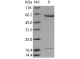 Recombinant Mouse ACE2 Protein (His Tag)