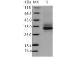 Recombinant Mouse Dectin-1/CLEC7A Protein (His Tag)