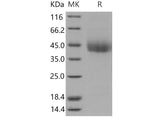 Recombinant Mouse CD226/DNAM-1 Protein (His Tag)(Active)