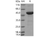 Recombinant Mouse S100A15/S100A7A Protein (His & MBP Tag)