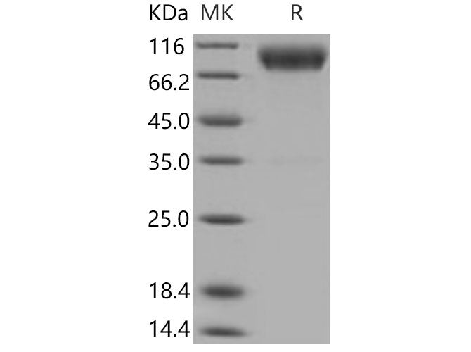 Recombinant Mouse CD200R1 Protein (His & Fc Tag)(Active)