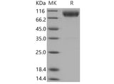 Recombinant Mouse CD200R1 Protein (His & Fc Tag)(Active)