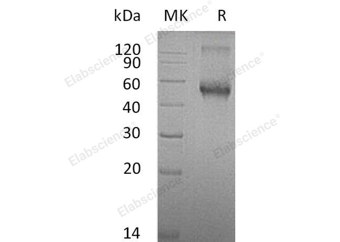 Recombinant Mouse ALK-1/ACVRL1 Protein (His & Fc Tag)(Active)