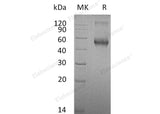 Recombinant Mouse ALK-1/ACVRL1 Protein (His & Fc Tag)(Active)