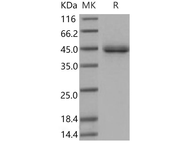 Recombinant Mouse SFTPD/SP-D Protein (His Tag)