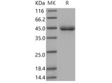 Recombinant Mouse SFTPD/SP-D Protein (His Tag)