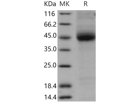 Recombinant Mouse CD1D/R3G1 Protein (His Tag)