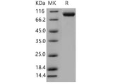 Recombinant Mouse VCAM1 Protein (His Tag)(Active)