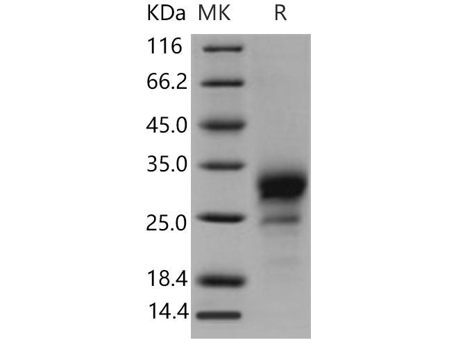 Recombinant Mouse TNFRSF19/TROY Protein (His Tag)