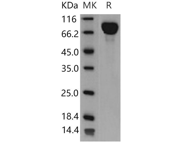 Recombinant Mouse IL6ST/CD130 Protein (His Tag)(Active)