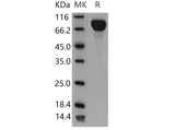 Recombinant Mouse IL6ST/CD130 Protein (His Tag)(Active)