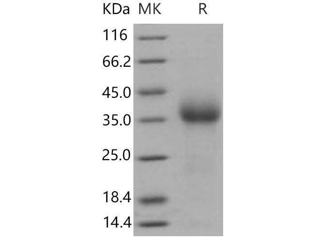 Recombinant Mouse CD27/TNFRSF7 Protein (His Tag)(Active)