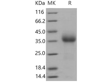 Recombinant Mouse CD27/TNFRSF7 Protein (His Tag)(Active)
