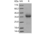 Recombinant Mouse CD27/TNFRSF7 Protein (His Tag)(Active)