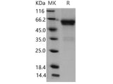 Recombinant Mouse CD27/TNFRSF7 Protein (His & Fc Tag)(Active)
