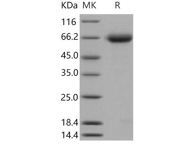 Recombinant Mouse Nogo Receptor/NgR Protein (His Tag)(Active)