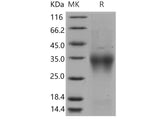 Recombinant Mouse CD28/TP44 Protein (His Tag)