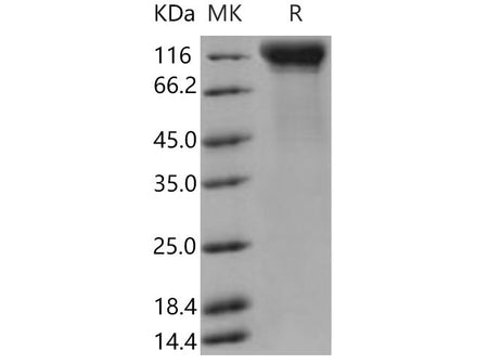 Recombinant Mouse IL12RB2/IL12R-beta 2 Protein (His Tag)(Active)