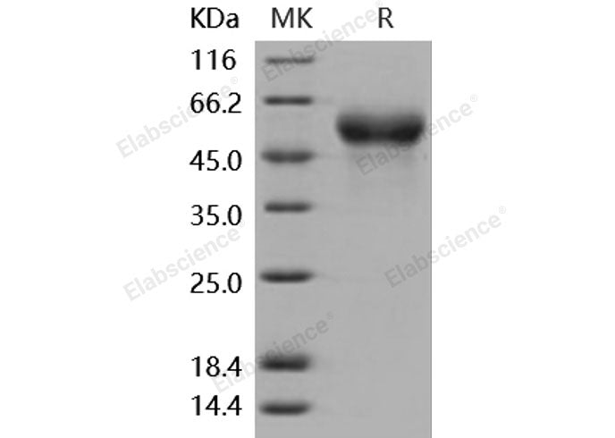Recombinant Mouse Fetuin-A/AHSG Protein (His Tag)(Active)