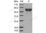 Recombinant Mouse Fetuin-A/AHSG Protein (His Tag)(Active)