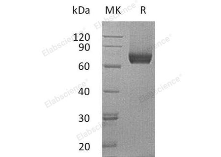 Recombinant Mouse IL7RA/CD127 Protein (His Tag)