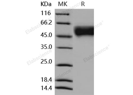 Recombinant Mouse IL2RG/CD132 Protein (His Tag)