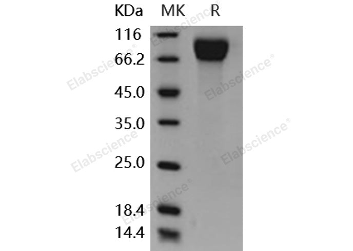 Recombinant Mouse CSF1R/CD115 Protein (His Tag)(Active)