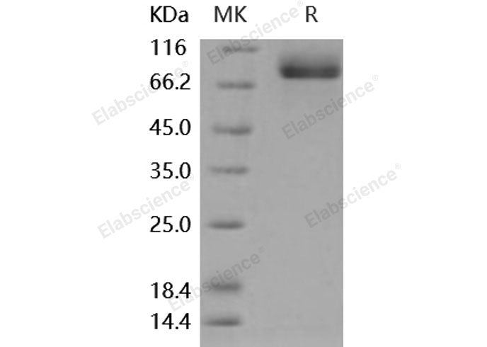 Recombinant Mouse MEP1A/PPHA Protein (His Tag)(Active)
