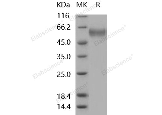 Recombinant Mouse sFRP4 Protein (His Tag)