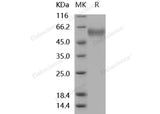 Recombinant Mouse sFRP4 Protein (His Tag)