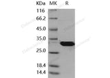 Recombinant Mouse Latexin/LXN Protein (His Tag)(Active)