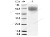 Recombinant Mouse L-Selectin/SELL Protein (His Tag)
