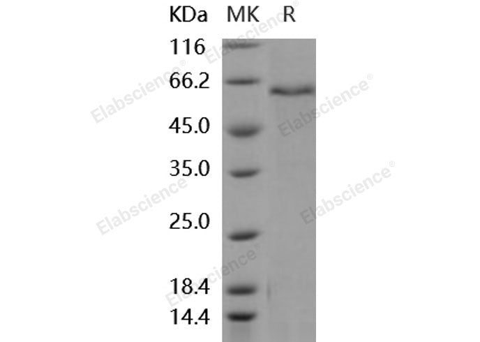 Recombinant Mouse ADAM9 Protein (His Tag)
