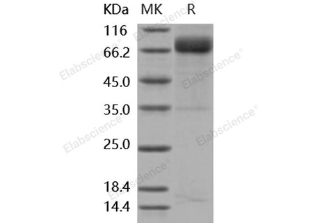 Recombinant Mouse GHR/GHBP Protein (His & Fc Tag)(Active)