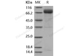 Recombinant Mouse GHR/GHBP Protein (His & Fc Tag)(Active)