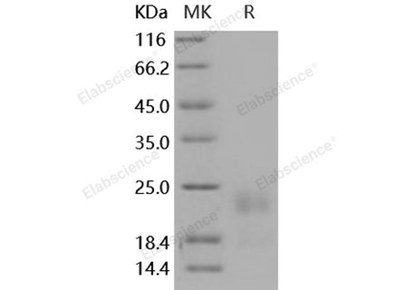 Recombinant Mouse HAI-2/SPINT2 Protein (His Tag)