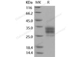 Recombinant Mouse CD16-2/FCGR4 Protein (His Tag)(Active)