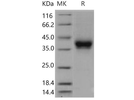 Recombinant Mouse CD32/FCGR2B Protein (His & AVI Tag), Biotinylated(Active)