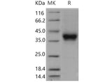 Recombinant Mouse CD32/FCGR2B Protein (His & AVI Tag), Biotinylated(Active)