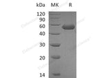 Recombinant Mouse CD5L Protein (His Tag)